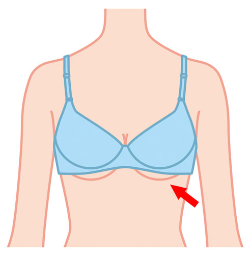 The bust should not bulge out on the underside of the bra cups