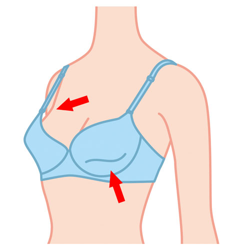 B cup to a full G cup. is it closer to H? I wanted a huge round breast but  natural cleavage and natural slope of upper pole. I got what I aimed